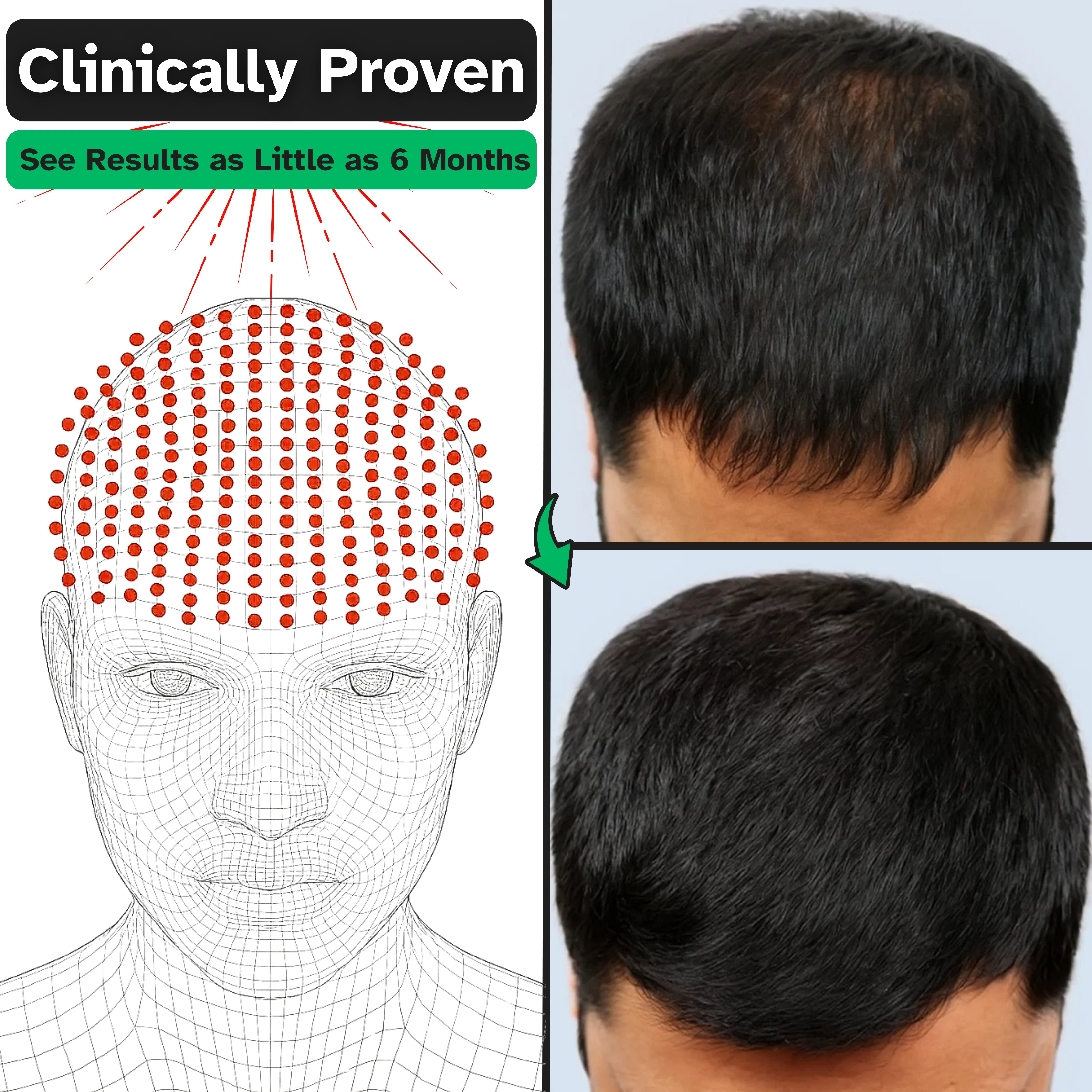 PrimeGrow™ — Red Light Therapy Cap for Hair Regrowth