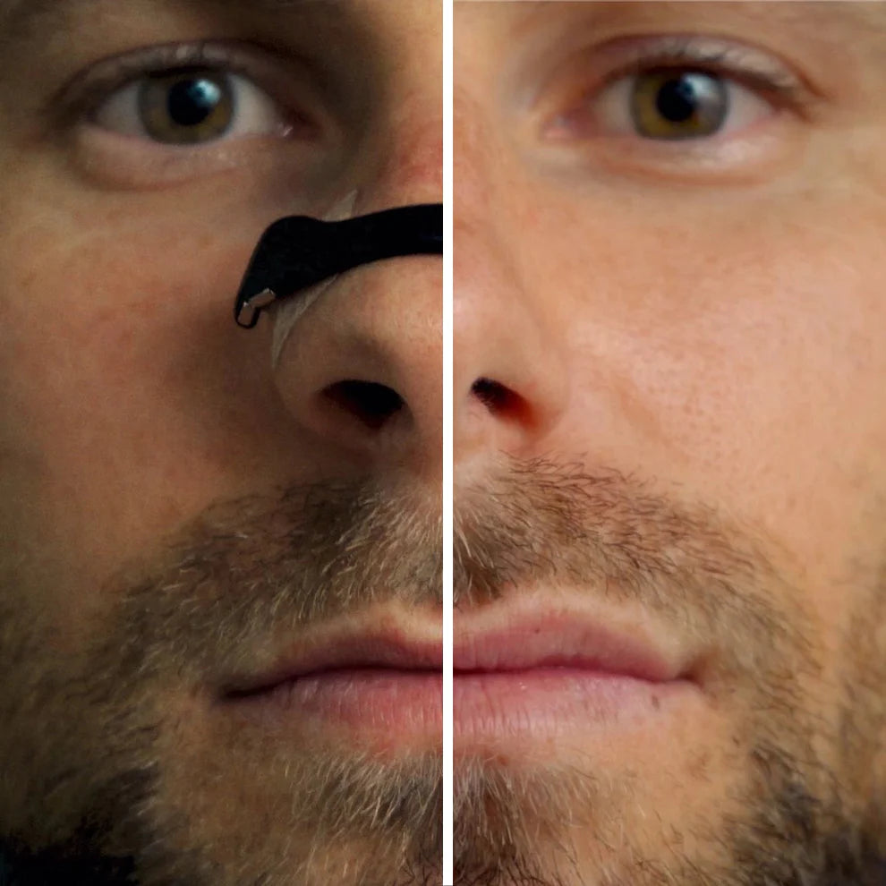 PrimeStrip™ — Anti-Snoring Nasal Strips for Better Sleep & Clear Breathing